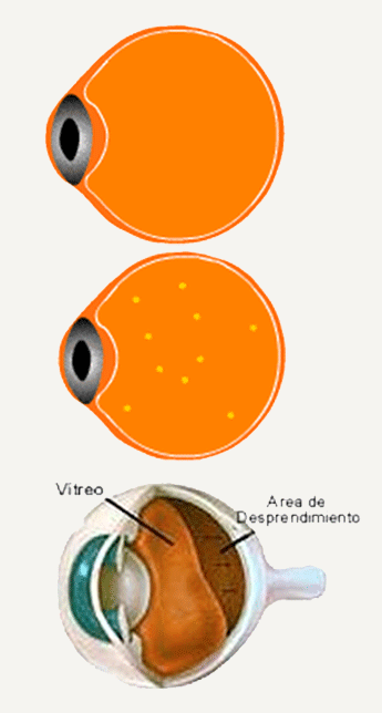 Figura ilustrativa macula