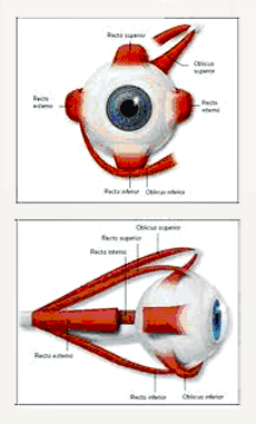 Figura ilustrativa causas del estrabismo